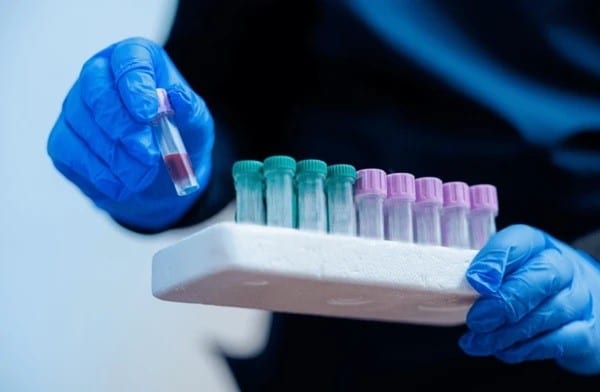 Why quality and traceability matter in coagulation reagents for IVD