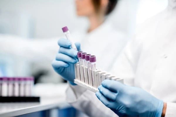 Don’t waste your valuable sera samples!