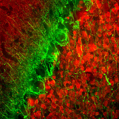 Immunofluorescence of a section of rat cerebellum selectively labeling the axons of granule cells with alpha-internexin 1:5000, green) and colabeled with anti-calretinin (red).