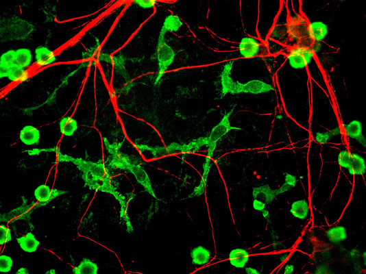 Immunofluorescence of cultured neurons and glia cells showing specific labeling of neuronal processes with Anti-alpha-internexin 1:500, red), and specific labeling of microglia with anti-coronin 1a (green).