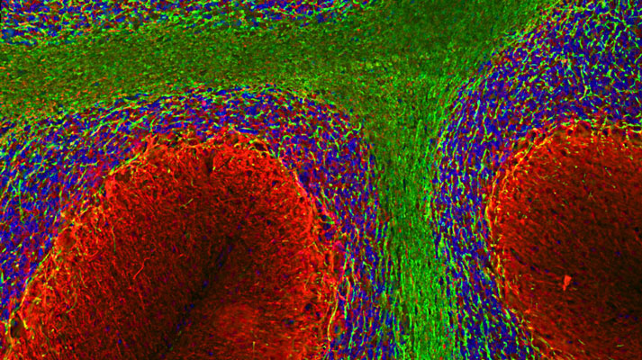 Immunofluorescence of a section of rat cerebellum showing labeling of axons of granule cell and dendrites of Purkinje with alpha-internexin 1:5000, red), labeling of the myelin sheaths around the axons with MBP 1:5000, green), and additional nuclear staining with DAPI (blue).