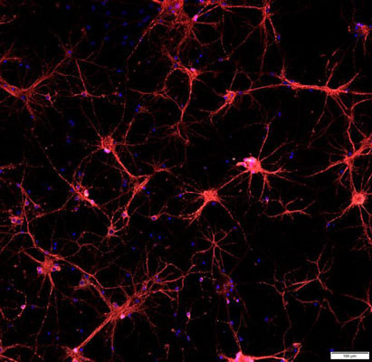 Immunofluorescent image of primary mouse neurons specifically labelling MAP2 1:1000, red). The blue nuclear stain is Hoechst. The image was kindly provided by Noah Johnson, University of Colorado, Anschutz Medical Campus.