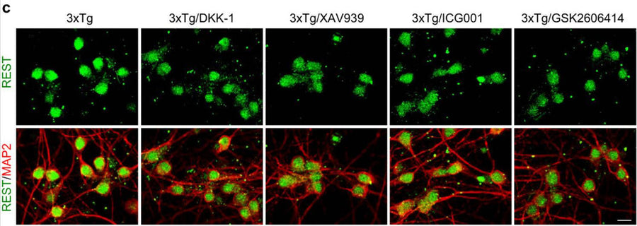 Immunolabeling of REST (green) and neuron marker MAP2 red) in 3xTg primary cortical neurons (PCNs) shows nuclear REST in neurons treated with vehicle and decreased nuclear REST in 3xTg neurons after a 24-h treatment with the Wnt/β-catenin inhibitors Dickkopf 1 (DKK1), XAV939 and ICG001, or the PERK inhibitor GSK2606414. Image from publication CC-BY-4.0. PMID: 37919281
