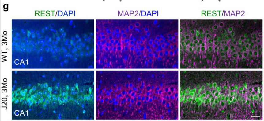 Immunolabeling of REST (green), the neuron marker MAP2 magenta) and nuclei (DAPI, blue) in the CA1 region of the hippocampus, shows elevated nuclear REST levels in 3-month-old J20 mice. Image from publication CC-BY-4.0. PMID: 37919281