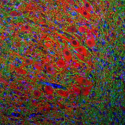 Immunofluorescence of a section of rat brain stem showing specific labeling of MAP2 1:2000, red) in the perikarya and dendrites of neurons and specific labeling of the myelin sheath around axons with anti-MBP 1:5000, green). The blue is DAPI revealing nuclear DNA.