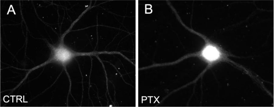 (A-B). Primary hippocampal neurons were stained with MAP2 1:1000) as a negative control under basal conditions (CTRL) and with picrotoxin treatment (PTX). Image from publication CC-BY-4.0. PMID: 37654026