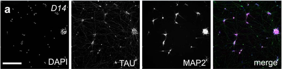 Day 14 (D14) RGC-iNs stained with a DAPI, TAU, and MAP2 1:1000). Image from publication CC-BY-4.0. PMID: 37773257