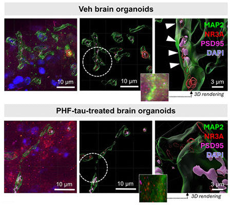 Representative 3D view images of paired helical filament (PHF)-tau-treated human brain organoid fractions. The organoids were labeled for MAP2 1:1000, green), NR3A (red), PSD95 (magenta), and DAPI (blue). White arrows show the positions colocalized between PSD95 and NR3A. The dotted circles show the magnified positions. Scale bar = 10 or 3 μm. Image from publication, CC-BY-4.0. PMID: 39396906