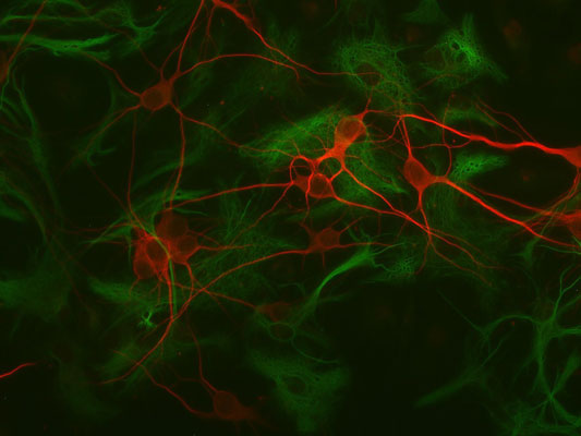 Immunolabeling of mouse hippocampal cultures labeled with Anti-GFAP 1:1000, green) and anti-MAP2 (1:1000, red).