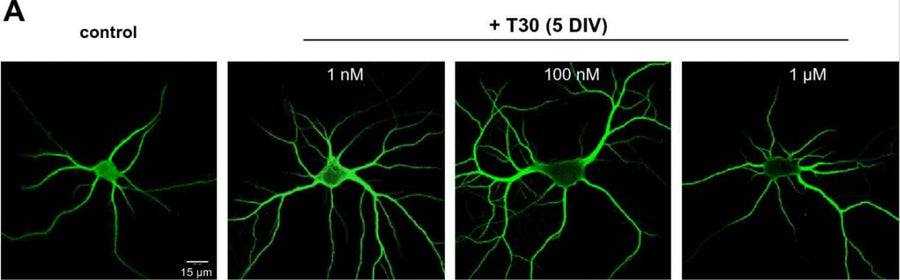 Representative images of anti-MAP2 immunolabeled rat neurons at 5 DIV of T30 treatment. Image from publication CC-BY-4.0. PMID: 37454238