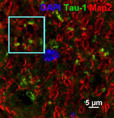 Immunostaining of rat hippocampus showing specific immunolabeling of MAP2 red, 1:1000), Tau-1 (green), and nuclear DNA labeled with DAPI (blue). Photo courtesy of the Miriam Zamorano, University of Texas Health Science Center at Houston.