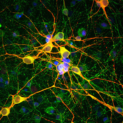 Immunofluorescence of cortical neuron-glial cell culture from E20 rat labeled with Anti- MAP2 red, 1:10,000), and Anti-Tau (green). The blue is DAPI staining of nuclear DNA. The anti-MAP2 antibody stains dendrites and perikarya of neurons, while the anti-TAU antibody labels neuronal perikarya, dendrites and also axonal process. As a result perikarya and dendrites appears orange-yellow, since they contain both MAP2 and tau, while axons are green.