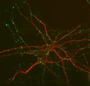 Immunolabeling of mouse hippocampal cultures labeled with anti-MAP2 1:1000, red) and anti-synapsin 1:1000, green).