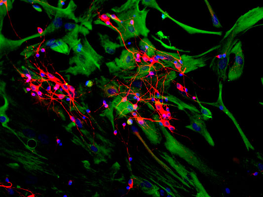 Immunostaining of mixed neuron and glial cultures showing specific cytoplasmic labeling of dendrites and perikarya of neuronal cells with anti-microtubule associated protein 2C/D red, 1:2500) and specific fibroblast, astrocyte labeling with anti-vimentin green, 1:500). The blue stain is DAPI to identify nuclei.