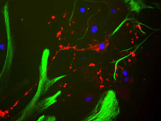 Immunostaining of cultured neonatal rat neurons and glia stained with anti-myelin basic protein antibody red, 1:500). The blue stain is to identify nuclear DNA. Note the antibody stains the myelin basic protein located in oligodendrocyte and myelin sheathes around axons in the cells.