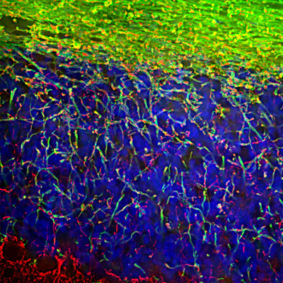 Immunofluorescence of a section of rat cerebellum showing specific labeling of myelin basic protein 1:5000, green) in the oligodendrocytes and myelin sheathes around axons. The section is colabeled with Anti-NFL (red) labeling dendrites and axons of neuronal cells. The blue stains nuclear DNA.