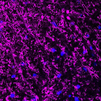 Immunofluorescence of a perpendicular section from mouse spinal cord gray matter (upper left corner) and white matter (lower right corner) labeling myelin basic protein (magenta, 1:500) from oligodendrocytes and myelin sheaths. The blue is DAPI counterstaining nuclear DNA. Image kindly provided by Dr. Rodolfo Gatto and Dr. Gerardo Morfini, Department of Anatomy and Cell biology, University of Illinois at Chicago.