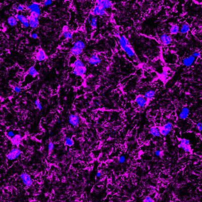 Immunofluorescence of a cross-section from mouse corpus callosum labeling myelin basic protein (magenta, 1:500) in oligodendrocytes and myelin sheaths. The blue is DAPI counterstaining nuclear DNA. Image kindly provided by Dr. Rodolfo Gatto and Dr. Gerardo Morfini, Department of Anatomy and Cell biology, University of Illinois at Chicago.