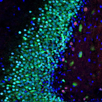 Immunostaining of a section of rat hippocampus showing specific nuclear immunolabeling of MeCP2 red, 1:1000) and FOX3 (green). The blue is DAPI staining of nuclear DNA.