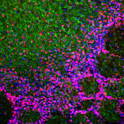Immunostaining of a section of rat olfactory bulb showing specific labeling of MeCP2 in neuronal nuclei red, 1:2000) and alpha synuclein (green). The blue is DAPI staining of nuclear DNA.