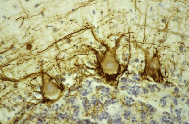 Immunostaining of human cerebellar cortex showing labeling of NF-H DAB, 1:500) in basket cell axons surrounding the large Purkinje neurons. Cerebellar granule cell layer is at the bottom of the image and the molecular layer at the top. Section was counterstained with Hematoxylin.