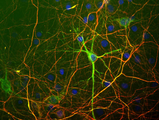 Immunostaining of mixed cultured rat neurons and glia stained with anti-NFH antibody red, 1:25,000) and anti-NFL antibody green, 1:100).