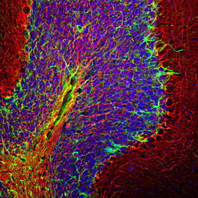 Immunofluorescence of a section of rat cerebellum showing specific labeling of Neurofilament H 1:25,000, red) in nuclei of neurons and specific labeling of GFAP 1:5000, green) in astrocytes and other glial cells, and DAPI staining of nuclear DNA.