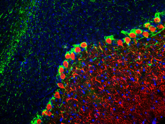 Immunofluorescence of a section of rat cerebellum showing specific labeling of the axons with anti-neurofilament H antibody green, 1:25,000). The section is colabeled with anti-calbindin red, 1:1000) labeling the dendrites of Purkinje cells. The blue is DAPI staining nuclear DNA.
