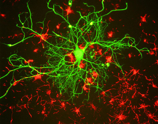 Immunostaining of mixed cultured rat neurons stained with anti-NFL antibody green, 1:100) and anti-alpha internexin.