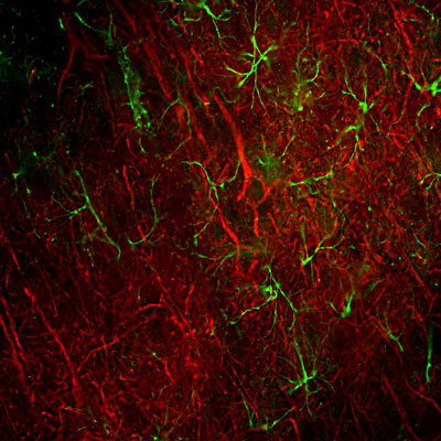 Immunofluorescence of a section of rat frontal cortex showing labeling of Neurofilament-L 1:500, red) and labeling of GFAP 1:5000, green). The anti-NFL antibody labels cell bodies and processes of pyramidal neurons, as well as dendrites and axons of other neuronal cells. While the anti-GFAP antibody labels the network of glial cells.