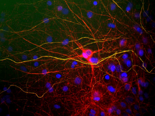 Immunostaining of mixed cultured rat neurons and glia stained with anti-NFL antibody red, 1:5000). The NF-L protein is assembled into neurofilaments which are found throughout the axons, dendrites, and perikarya as shown above.