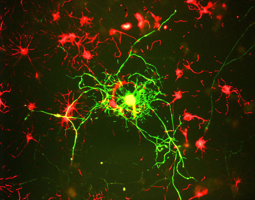 Immunostaining of cultured rat neurons showing labeling of NF-M green, 1:100) in mature neurons.