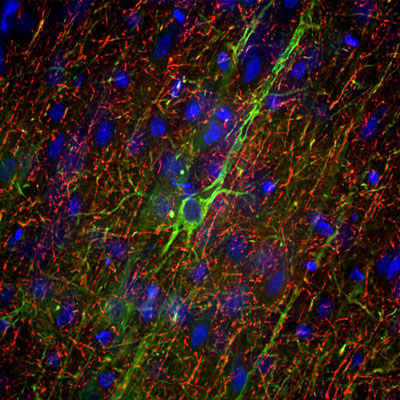 Immunofluorescence of a section of adult rat frontal cortex labeled with anti-Neurofilament-M 1:5000, red) and anti-Neurofilament-H 1:5000, green). The anti-NFM specifically labels neuron cell bodies and dendrites of pyramidal neurons, while the anti-NFH labels the network of neuronal axons only. The blue is Hoechst staining of nuclear DNA.