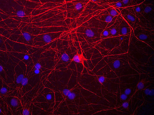 Immunostaining of cultured rat neurons and glia stained with anti-NFM antibody red, 1:1000) and DNA is stained blue.