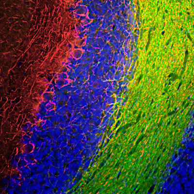 Immunofluorescence of a section of rat cerebellum labeled with anti-Neurofilament-M 1:1000, red) and anti-CNP (green). The anti-NFM labels the network of axons of basket neurons and other neurons. The blue is DAPI staining of nuclear DNA.