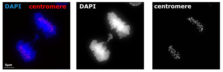 A microscopy image of a cell from BJ hTERT cell line treated with aphidicolin to induce genomic instability. Immunolabeling of the cell positively labelling CREST/Centromere Protein (red, 1:500, ) and labelling DNA with DAPI. The anaphase cell has a segregation error which lacks centromeric staining unlike the mass of properly segregating chromosomes. Image kindly provided by Nadeem Shaikh and Sarah McClelland from Barts Cancer Institute, Queen Mary University of London.