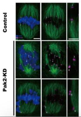 Control and Pak2-KD metaphase mouse oocytes were labeled with CREST antibody for kinetochores 1:300; purple), anti-tubulin antibody for microtubules (green), and Hoechst 33342 for chromosomes (blue). Image from publication CC-BY-4.0. PMID:36813765