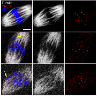 Representative images of the morphology of K-M attachments in MI oocytes from both control and BBP-exposed group. α-tubulin (gray); CREST 1:200; red); DNA (blue). Image from publication CC-BY-4.0. PMID:36756972