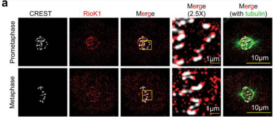 Representative immunofluorescence images of RioK1 at kinetochores (CREST) 1:50) in prometaphase and metaphase cells. Image from publication CC-BY-4.0. PMID:37263996