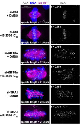 RPE-1 cells expressing H2B-GFP and α-Tub-mRFP (magenta) were treated as indicated, fixed and stained for centromeres (ACA) 1:400; white) and DNA (DAPI, blue). BI2536 was added at the IC30 concentration (5 nM). Representative cells are shown, with their measured spindle lengths and centromere dispersion ratios (r). Image from publication CC-BY-4.0. PMID:37639469