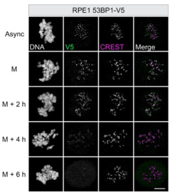RPE1 53BP1‐V5 cells were either left untreated (async = asynchronous) or synchronized in prometaphase in medium containing nocodazole, fixed immediately (M = mitosis) or after 2, 4, or 6 h and co‐stained with V5 and CREST 1:500). Image from publication CC-BY-4.0. PMID:37888778