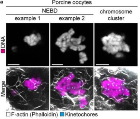 Immunofluorescence images of porcine oocytes shortly after NEBD (z-projections, example 1: 14 sections, example 2: 11 sections every 0.19 µm) and after chromosome cluster formation (z-projection, 14 sections every 0.19 µm). F-actin (phalloidin; white); kinetochores (ACA) 1:250; cyan); DNA (Hoechst, magenta,). Image from publication CC-BY-4.0. PMID:36732633