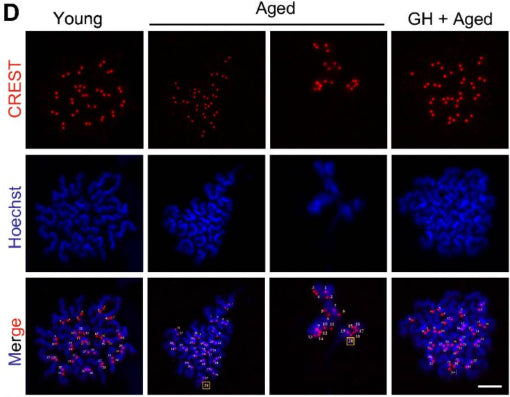 Representative images of chromosome spreading 1:200) of euploid and aneuploid mouse oocytes. Image from publication CC-BY-4.0. PMID:37386516