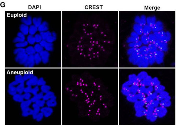 C3a-peptide treatment does not induce chromosome aneuploidy of mouse oocytes. Representative images of MII oocyte immunofluorescence stained with DAPI (blue) and anti-CREST 1:500; magenta) antibodies showing euploidy and aneuploidy in the oocytes, respectively (left). Image from publication CC-BY-4.0. PMID:38066646