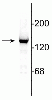 Western blot of 10 µg of rat cerebellar lysate showing specific immunolabeling of the ~140 kDa NR2C subunit of the NMDA receptor.