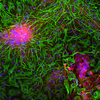 Immunolabeling of E20 rat mixed neuron and glial cultured cells labeled with anti-neuron specific enolase antibody red, 1:500) and anti-GFAP antibody green, 1:5000). The blue is Hoechst stain of nuclear DNA. Anti-NSE labels protein expressed in neuronal cells and anti-GFAP labels protein expressed in intermediate filaments in astrocytic and other glial cells.