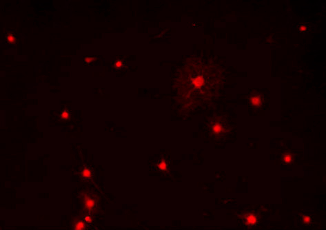 Immunostaining of primary rat oligodendrocytes using anti-Olig1 red, 1:100).