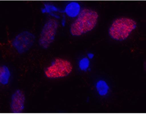 Immunostaining of primary rat cortical neuroepithelial cells with anti-Olig2 red, 1:1000). The cells were treated with basic FGF for 30 hours prior to staining (this induces Olig2 expression in these primary cells).