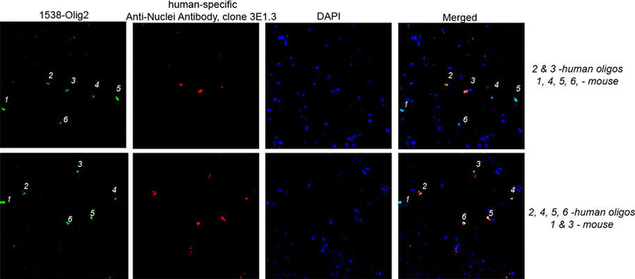 An illustration differentiating mouse and human oligodendrocytes in the process of glial humanization of a mouse brain model used to study HIV-1 infection. Immunoflourescence of paraffin embedded chimeric mouse brain 5-µm thick tissue section immunolabeling oligodendrocytes with anti-OLIG2 antibody 1:500, green) and a human specific anti-nuclei antibody(clone 3E1.3). The blue stain is DAPI. Images courtesy Larisa Poluektova, University of Nebraska Medical Center.