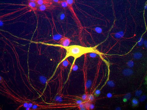 Immunoflourescence of cultured rat neurons and glia showing peripherin green, 1:500) and alpha-internexin (red). The blue stain is nuclear DNA. Cells expressing both peripherin and alpha-internexin appear yellow.